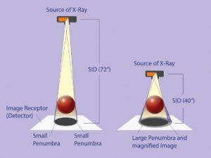 ADJUSTABLE SOURCE TO IMAGE DISTANCE HELPS IMPROVE RADIOGRAPHIC ...
